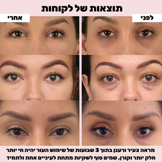 סרום איי גלואו