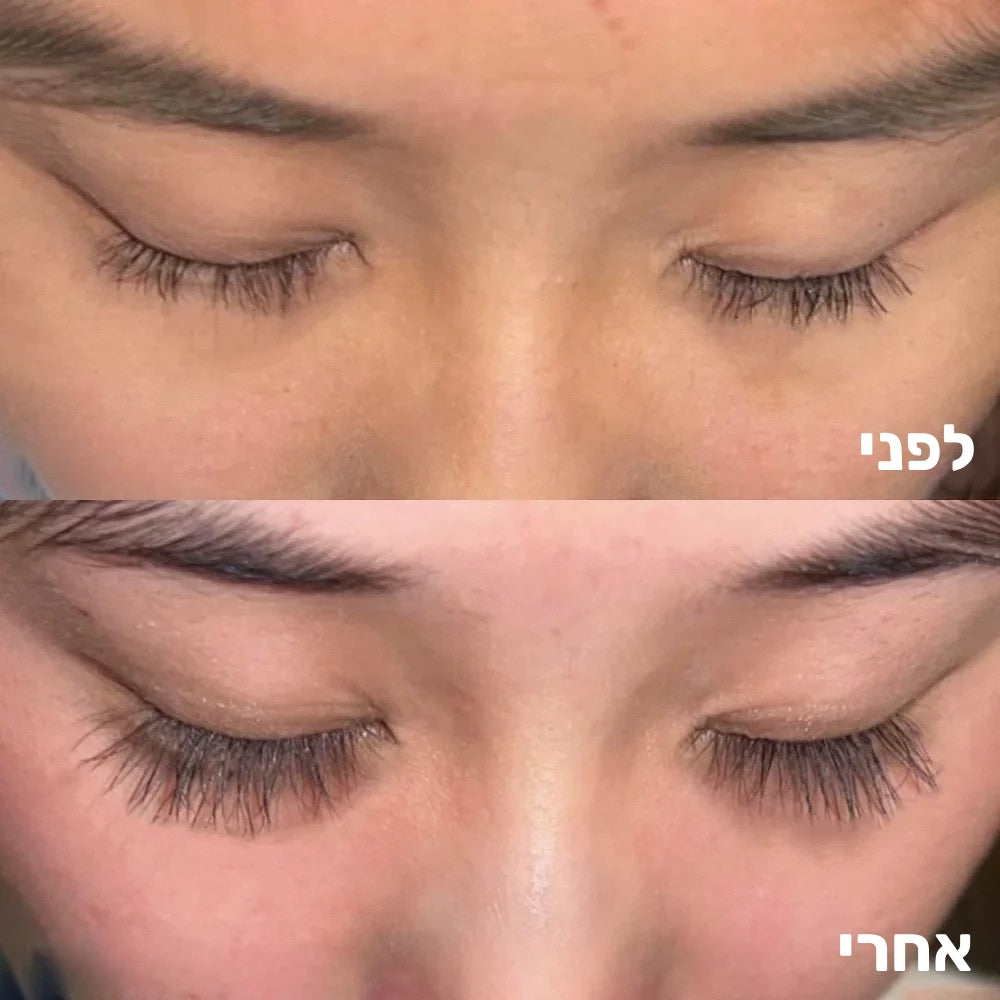 סרום מצמיח ריסים