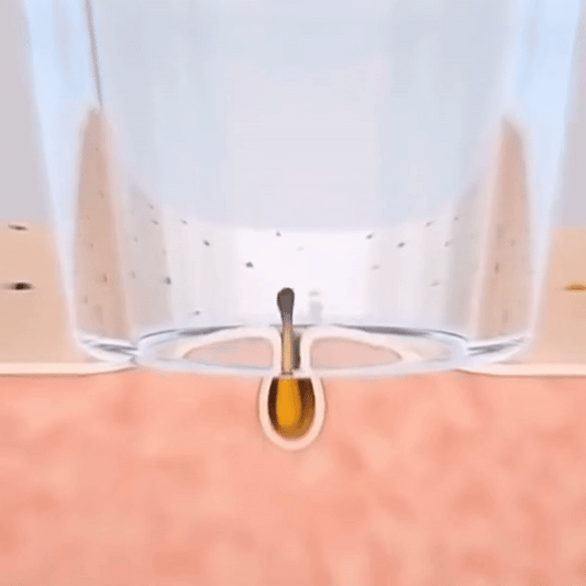 עט הסליל | מסיר שיער מקצועי מהגבות ומהפנים (Copy)